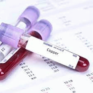  Copper Test Method: colorimetric with color card and comparator block with long test tubes MColortest™ Merck