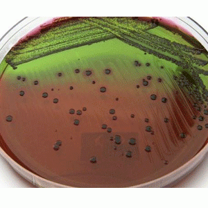 Hóa chất EMB agar for the detection and isolation of pathogenic Enterobacteriaceae-500g Merck
