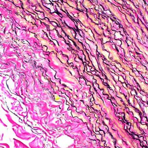 Hóa chất Elastica van Gieson staining kit for connective tissue Merck