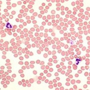 Hóa chất Giemsa's azur eosin methylene blue solution for microscopy Merck 