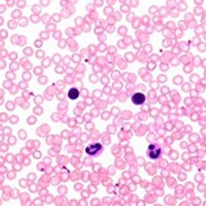 Hóa chất Hemacolor® Rapid staining of blood smear Solution colour reagent red Merck Đức