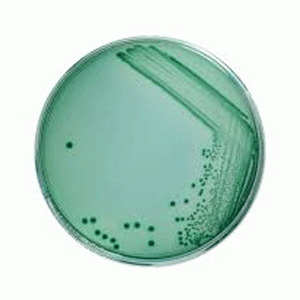 Hóa chất TCBS agar for the isolation and selective cultivation of Vibrio cholera