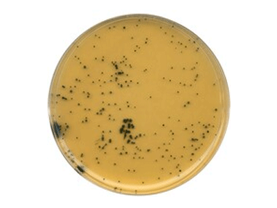 Tryptose-Sulfite-Cycloserine Tryptose-Sulfite-Cycloserine